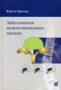 Заболевания межпозвонковых дисков. 2-е изд. Кремер Ю.