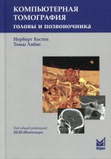 Компьютерная томография головы и позвоночника. 3-е изд. Хостен Н., Либиг Т.