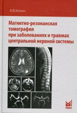 Магнитно-резонансная томография при заболеваниях и травмах центральной нервной системы. 2-е изд. Холин А.В.