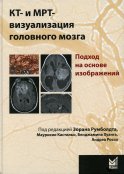 КТ- и МРТ- визуализация головного мозга. Подход на основе изображений. 2-е изд. Под ред. Румболдт З.