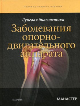Лучевая диагностика. Заболевания опорно-двигательного аппарата. 2-е изд. Манастер Б.Дж.
