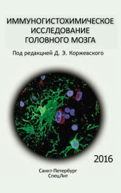 Иммуногистохимическое исследование головного мозга