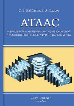 Атлас нормальной анатомии магнитно-резонансной и компьютерной томографии головного мозга