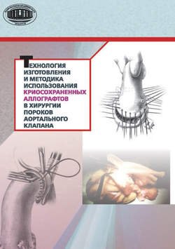 Технология изготовления и методика использования криосохраненных аллографтов в хирургии пороков аортального клапана