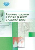 Клеточные технологии в лечении пациентов с рецессией десны