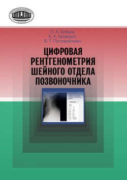 Цифровая рентгенометрия шейного отдела позвоночника