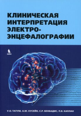 Клиническая интерпретация электроэнцефалографии