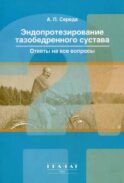 Эндопротезирование тазобедренного сустава. Ответы на все вопросы