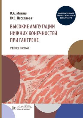 Высокие ампутации нижних конечностей при гангрене: Учебное пособие