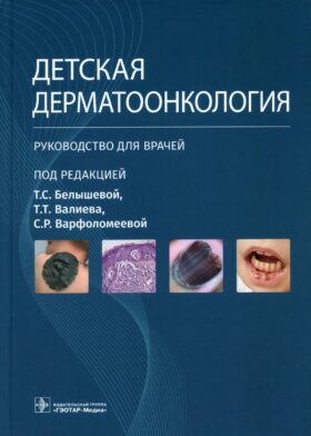 Детская дерматоонкология: руководство для врачей