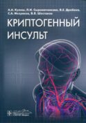 Криптогенный инсульт: руководство