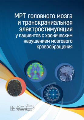 МРТ головного мозга и транскраниальная электростимуляция у пациентов с хроническим нарушением мозгового кровообращения