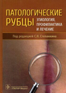 Патологические рубцы. Этиология, профилактика и лечение