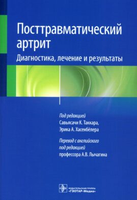 Посттравматический артрит. Диагностика, лечение и результаты