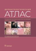 Дерматологический атлас. 2-е изд., доп