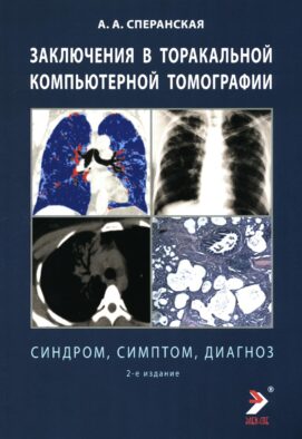 Заключение в торакальной компьютерной томографии. Симптом, синдром, диагноз. 2-е изд