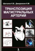 Транспозиция магистральных артерий
