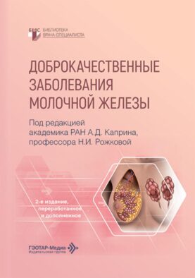 Доброкачественные заболевания молочной железы. 2-е изд., перераб. и доп