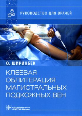 Клеевая облитерация магистральных подкожных вен: руководство для врачей